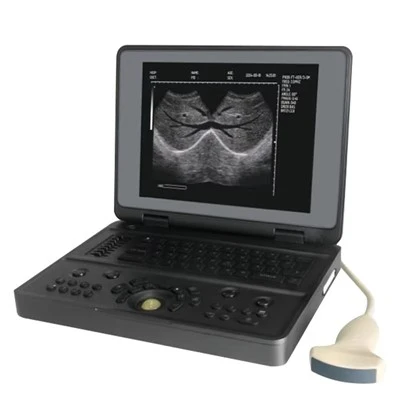 Digitalt ultralydsbilledsystem