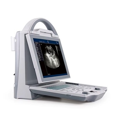 Bærbar bærbar ultralydsmaskinescanner